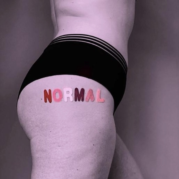 CONSIGLI PER CONTRASTARE LA CELLULITE